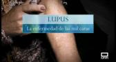 Lupus: la enfermedad de las mil caras