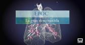 Epoc, la gran desconocida