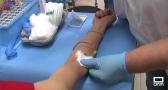 La ampliación de puntos de analíticas de sangre llega al consultorio de Albaladejo