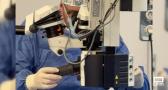 El hospital de Albacete estrena la Unidad de Braquiterapia Ocular