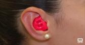 Otitis e infecciones son algunos de los riesgos más frecuentes durante el verano