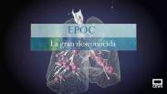 Epoc, la gran desconocida