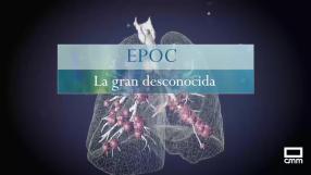 Epoc, la gran desconocida
