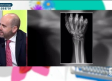 Aprende a leer una radiografía con el Dr. Fernando García