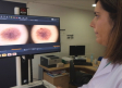 El hospital de Guadalajara incorpora la inteligencia artificial para la detección de melanomas