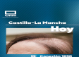 Conexión 1030: La alopecia en mujeres