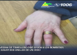 Una vecina de Tomelloso pide ayuda a los bomberos para sacar dos anillos de un dedo
