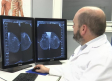 Así ayuda la inteligencia artificial en el campo de la radiología