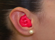 Otitis e infecciones son algunos de los riesgos más frecuentes durante el verano