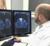 Así ayuda la inteligencia artificial en el campo de la radiología