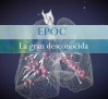 Epoc, la gran desconocida