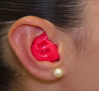 Otitis e infecciones son algunos de los riesgos más frecuentes durante el verano