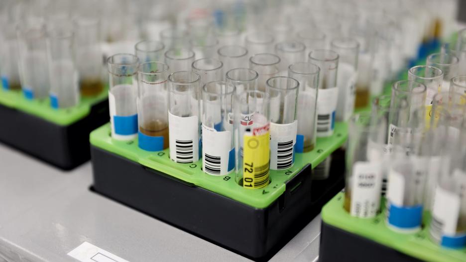 Probetas de pruebas PCR en el Laboratorio de Microbiología del Hospital público Gregorio Marañón, a 31 de mayo de 2022, en Madrid (España). El centro hospitalario, junto a otros cuatro en la región, ha comenzado a realizar pruebas PCR para la viruela del 