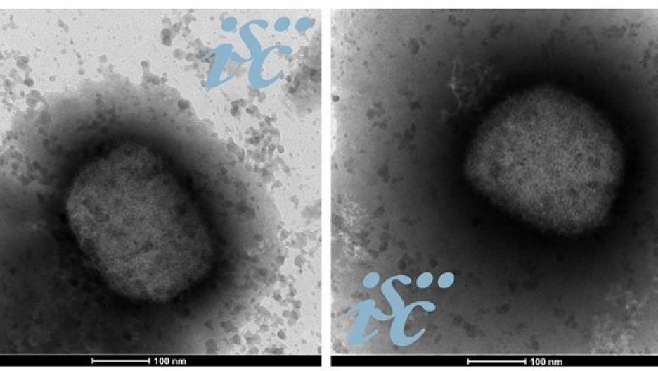 Dos imágenes, obtenidas por microscopía electrónica, del virus de la viruela del mono. Imagen: Unidad de Microscopía Electrónica del ISCIII
ISCIII
22/7/2022