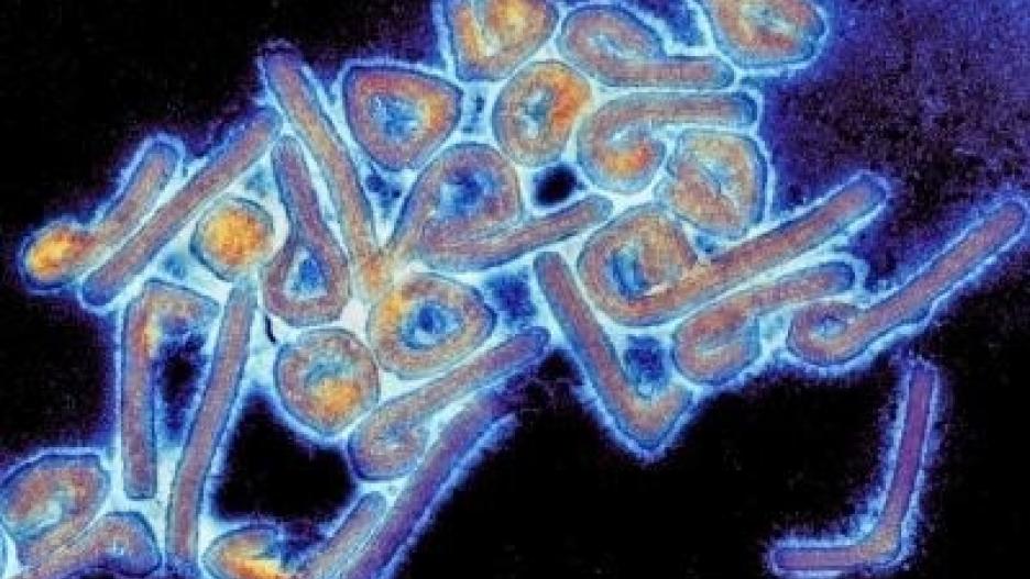Virus de Marburgo
THOMAS GEISBERT/UNIVERSIDAD DE TEXAS MEDICAL BRANC
(Foto de ARCHIVO)
20/8/2014