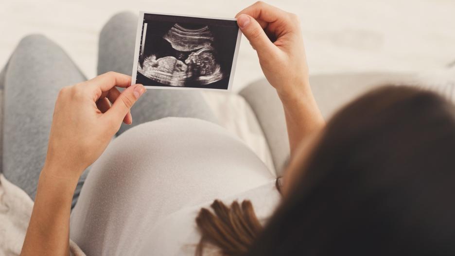 Mujer embarazaba mirando una ecografía de bebé. Archivo.