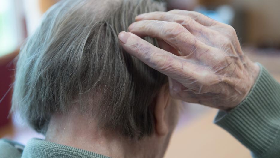 FILED - 10 May 2019, Saxony, Bernsdorf: A man scratches his head in a nursing home. Photo: Sebastian Kahnert/dpa-Zentralbild/dpa
(Foto de ARCHIVO)
10/5/2019 ONLY FOR USE IN SPAIN