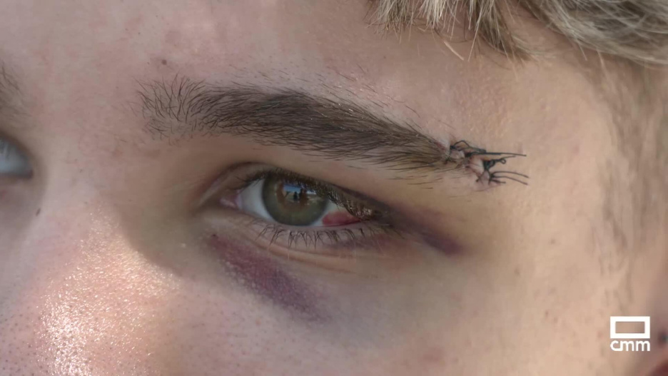 El joven recibió varios puntos de sutura a consecuencia de la agresión.